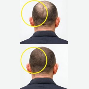 Hair Growth Serum For Promoting Hair Growth & Controlling Hair Fall With 3% Redensyl, 5% Capixyl, 4% Anagain, 3% Procapil & 3% Baicapil, Rosemary & Biotin, For Both Men & Women, 30ML