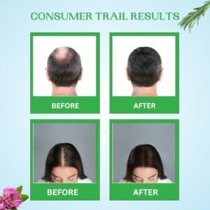 Exotic Aromas-Exotic Hair Boost Serum with 3% Redensyl, 3% Rosemary, 4% Anagain & 4% Biacapil, 30 ML, for hair loss, hair growth, thinning, baldness, for thicker & denser Hair. For Men & Women