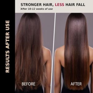 Hair Growth Serum with Redensyl, DHT Blocker, Biotin, Natural Keratin | Thick Density | Targets Hair Growth, Hair Fall, Damaged Scalp for Men & Women | 3.38 Fl Oz / 100 Ml