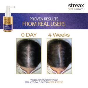 Streax Hair Growth Serum for Scalp, 30 ml with 3% Redensyl, 3% Anagain, 3% Baicapil, Biotin & Caffeine, For Hair Fall Control, For Women & Men