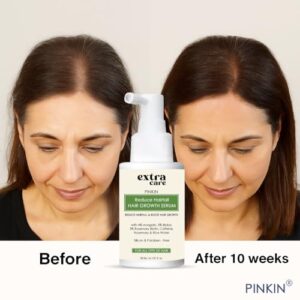 Extra Care Reactivate Hair Growth Serum For Men & Women | With 4% Anagain, 2% Bioba, 3% Rosemary, Biotin, Caffeine, Rosemary & Rice Water | For All Hair Types - 30ml