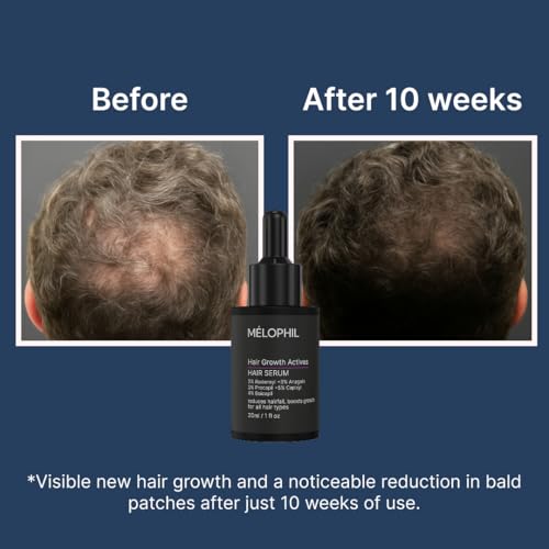 Hair Growth Serum - 3% Redensyl, 3% Anagain, 3% Procapil, 5% Capixyl, 4% Baicapil - Hair Fall Control, Advanced Growth Formula - 30ml