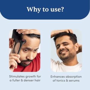 Man Matters 1.00 mm Derma Roller with Disinfectant | With 540 Titanium Alloy Needles | Promotes Beard & Hair Growth & Reduces Acne Scars | Safe & Effective to Use