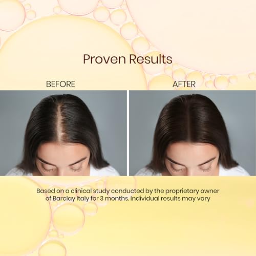 Hair Growth Serum ? 4% Capixyl, 3% Redensyl, 4% Anagain, 3% Procapil, 3% Baicapil, 3% Rosemary, Copper Peptides, Biotin & ? Oil-Based Hair Fall Control & Regrowth Serum for Men & Women ? 50ml