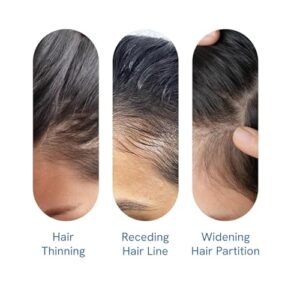 Be Bodywise 3% Redensyl & Rosemary Hair Growth Serum (Roll On) | Pack of 2 |with 2% Anagain | Thicker & Stronger Hair | Prevents Hairfall & Stimulates Hair Follicles | For All Hair Types | 25ml each