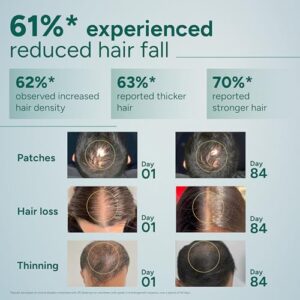 Arata Hair Growth Serum (30ml) with 3% Redensyl, 3% Procapil, 5% Kopexil, Caffeine & Rice Water | No Minoxidil | Supports Hair Growth | Helps Reduce Hairfall | Serum For Women and Men