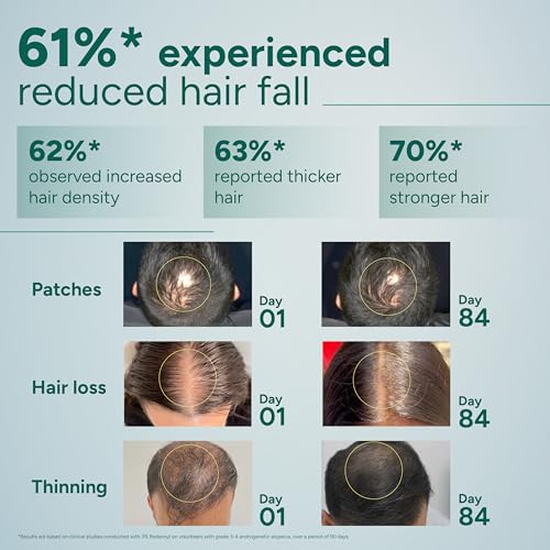 Arata Hair Growth Serum (30ml) with 3% Redensyl, 3% Procapil, 5% Kopexil, Caffeine & Rice Water | No Minoxidil | Supports Hair Growth | Helps Reduce Hairfall | Serum For Women and Men