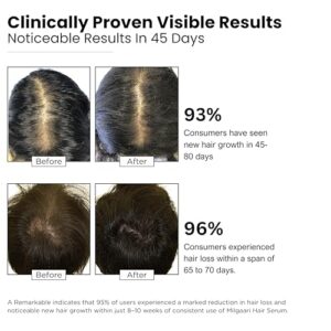 Advanced Hair Growth Serum ? Clinically Proven Actives 3% Redensyl, 4% Anagain, 3% Baicapil, Caffeine | Boosts Density, Reduces Hair Loss, Hair Growth & Hair fall Control Serum Dermatologically Tested, Non-Greasy 30ml