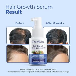 Hair Growth Serum 4% Anagain,3% Redensyl,2% Baicapil,1% Capilia Longa, Caffeine,Biotin & Rice Water With Rosemarry Advanced Hair Growth for Hair Fall Control Hair Serum for Women & Men 30ml