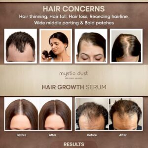 Hair Growth Serum | 2% Redensyl, 3% Anagain, 3% Procapil, 1% Capilia Longa, Biotin & Caffeine | Strengthens Weak Hair, Prevents Hair Fall & Promotes Hair Growth | For Men & Women | 50ml