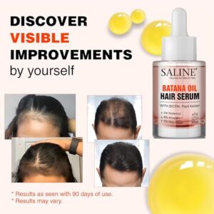 SALINE Batana Redensyl Hair Growth Serum with Biotin, 3% Redensyl, 4% Anagain, 2% Rice Water, and Plant Keratin 30ml - Hair Growth Serum for Men & Women