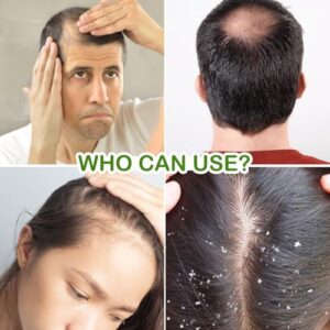 Jovees Herbal Rosemary Water Spray for Hair Growth & Hair Thickness with Follicusan DP | 100% Natural Extract Mist for Controls Hairfall, Strengthens Follicles & Boosts Hair Growth | Non-Greasy, Lightweight | All Hair Type - 200ml