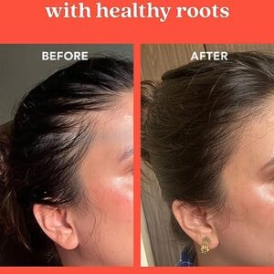 The Living Co. Shikakai + Bhringraj Stimulating Scalp Serum For Hair Growth 65Ml With Bhringraj | For Men & Women (1 Month Pack), 100 Grams