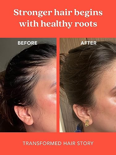 The Living Co. Shikakai + Bhringraj Stimulating Scalp Serum For Hair Growth 65Ml With Bhringraj | For Men & Women (1 Month Pack), 100 Grams