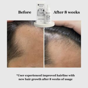 ZEDAN Hair Growth Serum Spray (50 ML) | Control Hair Fall & Promotes Hair Growth | Redensyl, Anagain, Procapil, Baicapil | Strengthen Roots & Hydrate Scalp | All Hair Types | For Women & Men